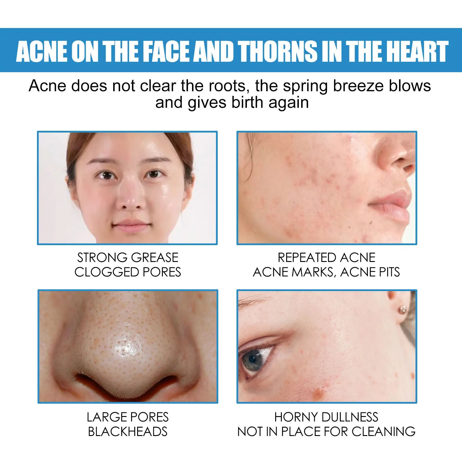 Centella Asiatica Repair Cream For Moisturizer Boost Skin Metabolism Brighten Skin Restore Skin Shrink Pores A-cne Removal Cream